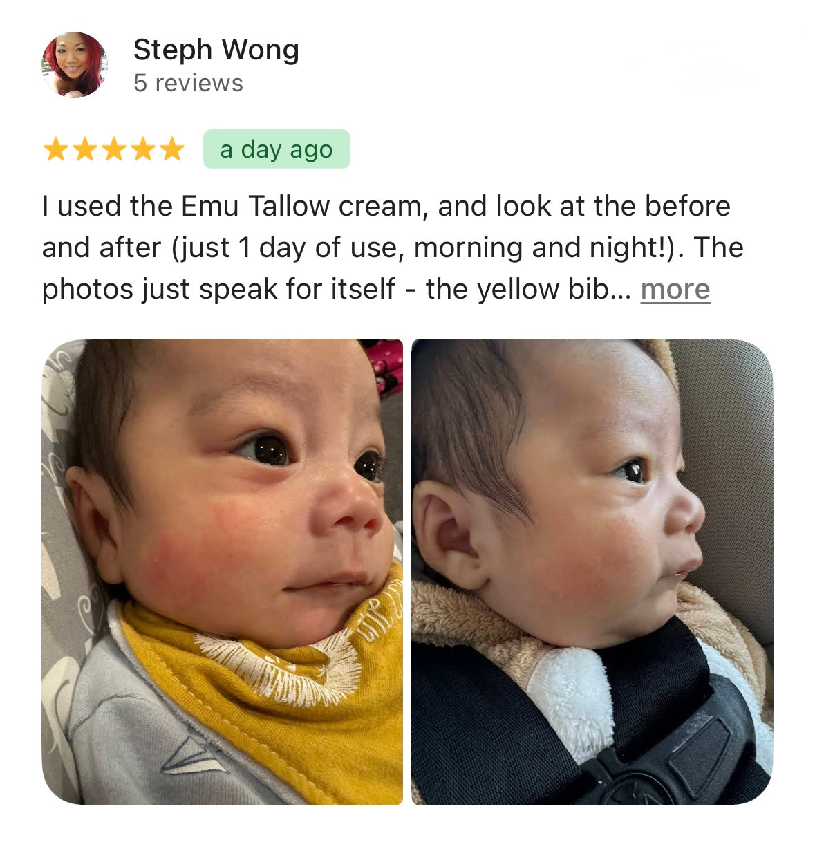 How Tallow Helps Babies Skin