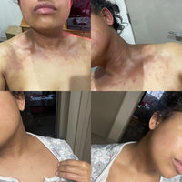 user before after review